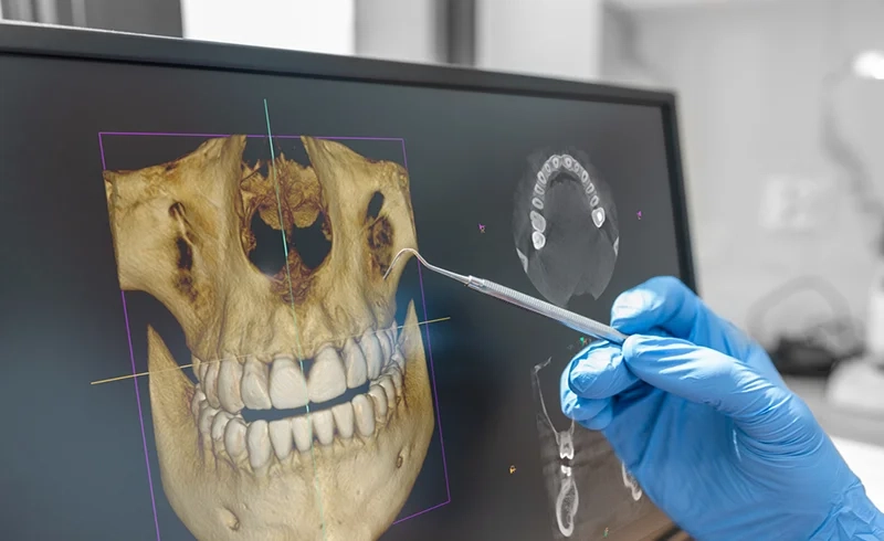 3D Dental Xrays – Absolute Essential For A Modern Successful Practice