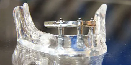 Trefoil System Image 1