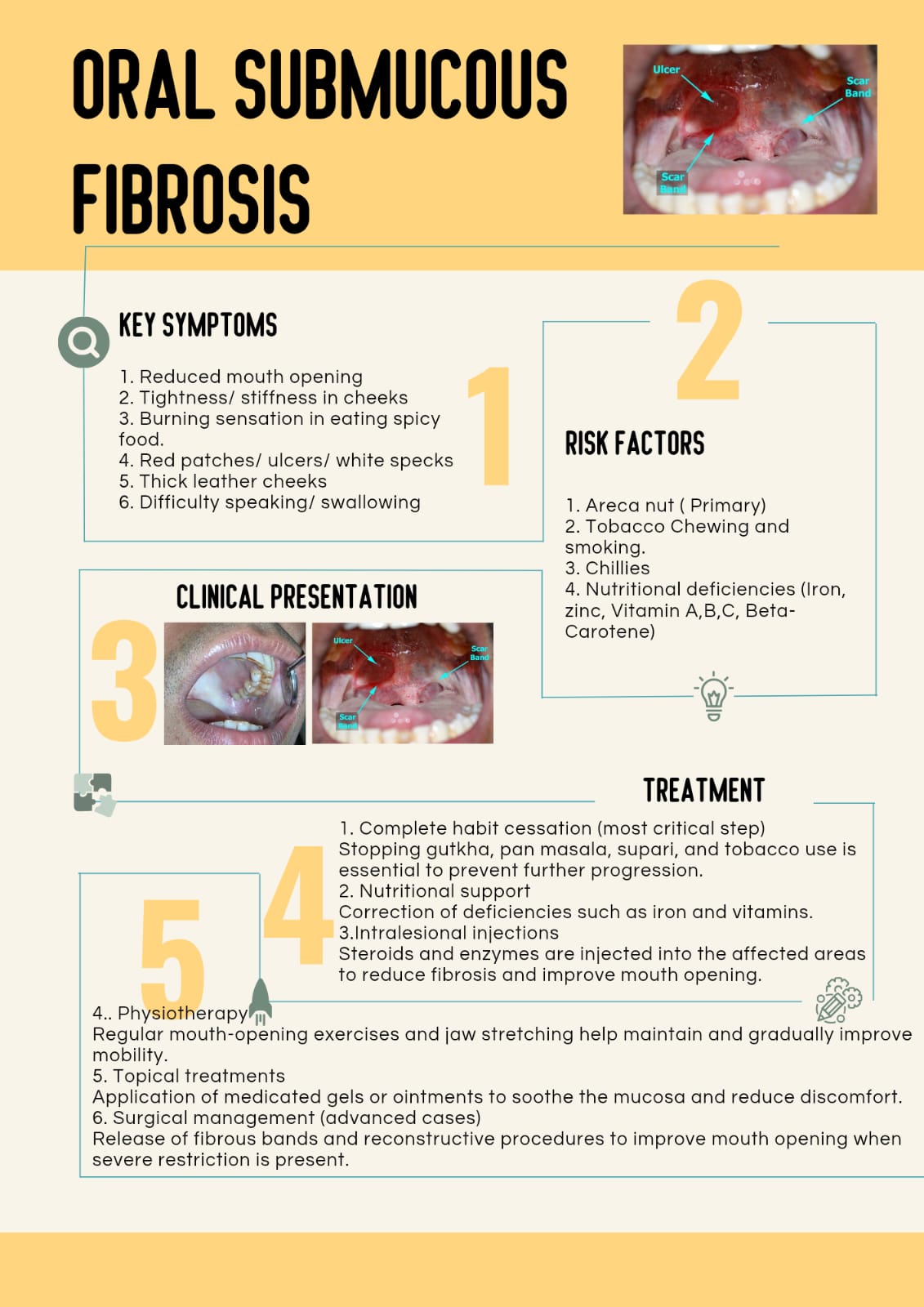 oral-submucous-fibrosis